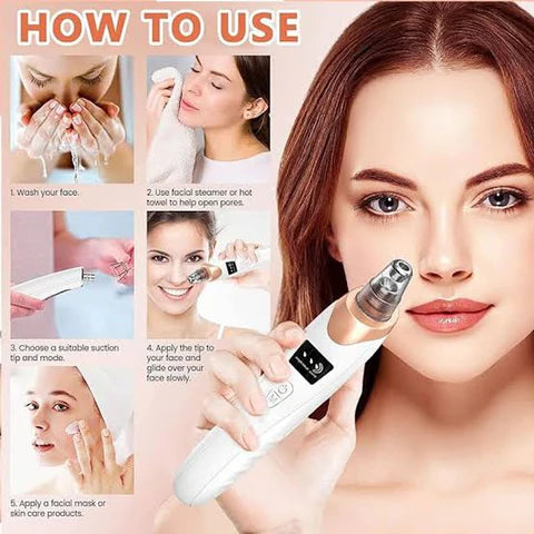 Original Rechargeable White Black Head Remover Machine