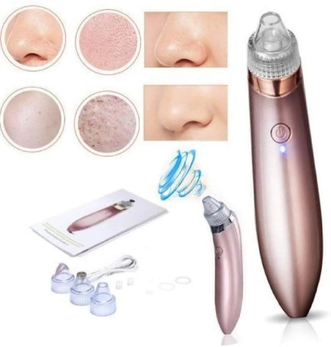 Original Rechargeable White Black Head Remover Machine